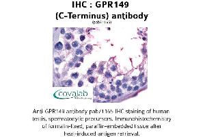 Image no. 1 for anti-G Protein-Coupled Receptor 149 (GPR149) (C-Term) antibody (ABIN1734954) (GPR149 抗体  (C-Term))