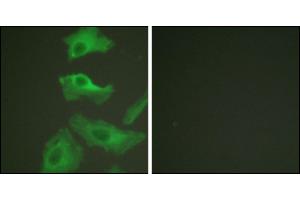 Immunofluorescence analysis of HeLa cells, treated with TNF-a (20nM, 15 mins), using HSP90B (Ab-254) antibody. (HSP90AB1 抗体)