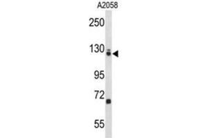 Western Blotting (WB) image for anti-Elongation Factor Tu GTP Binding Domain Containing 2 (EFTUD2) antibody (ABIN3004116) (EFTUD2 抗体)