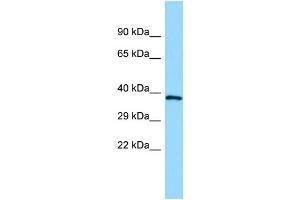 WB Suggested Anti-GPR160 Antibody Titration: 1. (GPR160 抗体  (C-Term))