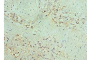 Immunohistochemistry of paraffin-embedded human gallbladder tissue using ABIN7150715 at dilution of 1:100 (MAP2K5 抗体  (AA 1-190))