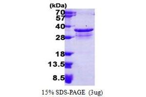 Proteasome (Prosome, Macropain) Inhibitor Subunit 1 (PI31) (PSMF1) (AA 1-271) protein (His tag)