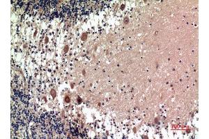 Immunohistochemistry (IHC) analysis of paraffin-embedded Human Brain, antibody was diluted at 1:100. (5HT1D 抗体)