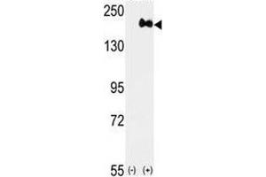 Western blot analysis of anti-HER2 antibody and 293 cell lysate (2 ug/lane) either nontransfected (Lane 1) or transiently transfected with the ERBB2 gene (2). (ErbB2/Her2 抗体  (AA 1227-1255))