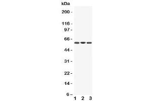 Western blot testing of Dopamine Receptor D5 antibody and Lane 1:  rat brain (DRD5 抗体  (C-Term))