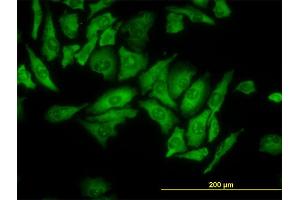 Immunofluorescence of monoclonal antibody to RPL4 on HeLa cell. (RPL4 抗体  (AA 251-350))