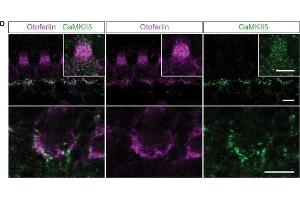 Immunofluorescence (Paraffin-embedded Sections) (IF (p)) image for anti-Calcium/calmodulin-Dependent Protein Kinase II delta (CAMK2D) antibody (ABIN2856806)