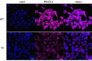 Immunocytochemical staining of HeLa cells using PRKCSH antibody (ABIN7799984), 1:1,000), Top panel: wild-type (WT), Bottom panal: PRKCSH shRNA knockdown (KD). (Recombinant PRKCSH 抗体)