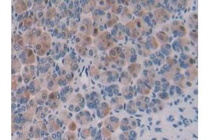 Detection of IPO8 in Mouse Stomach Tissue using Polyclonal Antibody to Importin 8 (IPO8) (Importin 8 抗体  (AA 417-622))