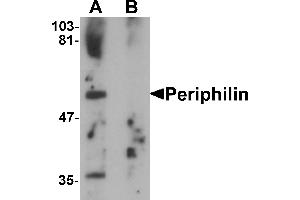 Western blot analysis of Periphilin in mouse colon tissue lysate with Periphilin antibody at 1 µg/mL in (A) the absence and (B) the presence of blocking peptide. (PPHLN1 抗体  (Middle Region))