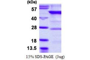 Tyrosyl-tRNA Synthetase 2, Mitochondrial (YARS2) (AA 17-477) protein (His tag)