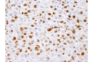 Immunohistochemistry (IHC) image for anti-Minichromosome Maintenance Complex Component 2 (MCM2) (pSer41) antibody (ABIN7448648)
