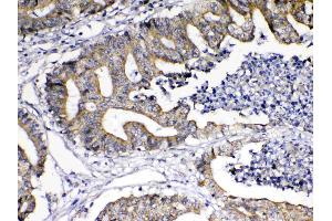 IHC analysis of TNFSF18 using anti-TNFSF18 antibody . (TNFSF18 抗体  (AA 70-199))