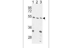 Western blot analysis of FOXP3 Antibody (C-term) (ABIN389295 and ABIN2839415) in 293(lane 1), Jurkat cell line(lane 2) and mouse liver tissue(lane 3) lysates (35 μg/lane). (FOXP3 抗体  (C-Term))