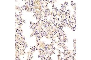 Immunohistochemistry analysis of paraffin-embedded rat lung using,HIPK2 (ABIN7074255) at dilution of 1: 1000