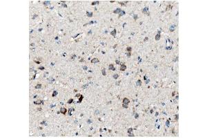 IHC analysis of Ch TOG/CKAP5 using anti-Ch TOG/CKAP5 antibody (ABIN7599106).
