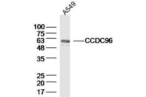 Lane 1: A549 lysates probed with CCDC96 Polyclonal Antibody, Unconjugated  at 1:300 overnight at 4˚C. (CCDC96 抗体  (AA 301-400))