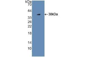 WB of Protein Standard: different control antibodies against Highly purified E. (PLG CLIA Kit)