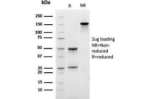 SDS-PAGE Analysis Purified LLC Recombinant Mouse Monoclonal Antibody (rLLC/3777). (Recombinant IgL 抗体)