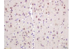 Formalin-fixed and paraffin embedded mouse brain labeled with Rabbit Anti-NARC1 Polyclonal Antibody, Unconjugated (ABIN761831) at 1:200 followed by conjugation to the secondary antibody and DAB staining