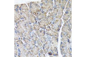 Immunohistochemistry of paraffin-embedded rat pancreas using PLTP Rabbit mAb (ABIN7269357) at dilution of 1:100 (40x lens). (PLTP 抗体)