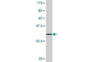 Western Blot detection against Immunogen (38. (SPTLC2 抗体  (AA 453-561))