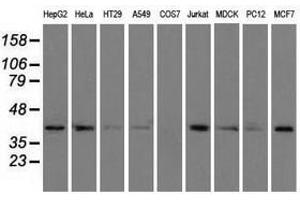 Image no. 7 for anti-Acetyl-CoA Acetyltransferase 2 (ACAT2) antibody (ABIN1496403) (ACAT2 抗体)