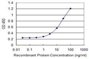 Detection limit for recombinant GST tagged RTKN2 is 0. (RTKN2 抗体  (AA 1-163))