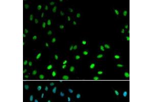 Immunofluorescence analysis of MCF-7 cells using RFC1 Polyclonal Antibody (RFC1 抗体)