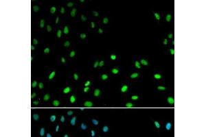 Immunofluorescence analysis of MCF-7 cells using RFC1 Polyclonal Antibody (RFC1 抗体)