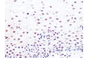 Immunohistochemistry of paraffin-embedded human esophageal using SUMO2/3 Rabbit mAb (ABIN7270370) at dilution of 1:100 (40x lens). (SUMO2 抗体)