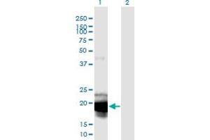 Western Blot analysis of IL23A expression in transfected 293T cell line by IL23A monoclonal antibody (M01), clone 4C8. (IL23A 抗体  (AA 1-189))