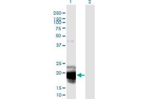 Western Blot analysis of IL23A expression in transfected 293T cell line by IL23A monoclonal antibody (M01), clone 4C8.