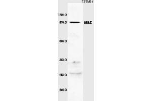 Human colon carcinoma lysates probed with Anti PI 3 Kinase p85 beta Polyclonal Antibody, Unconjugated (ABIN754723) at 1:200 overnight at 4 °C. (PIK3R2 抗体)
