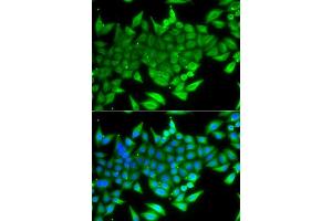 Immunofluorescence analysis of A549 cells using TTF2 antibody. (TTF2 抗体  (AA 1-270))