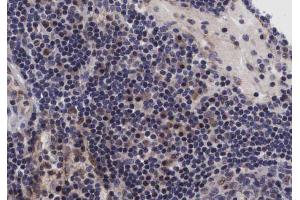 ABIN6267432 at 1/200 staining human lymph nodes tissue sections by IHC-P. (NFKB1 抗体  (pSer907))