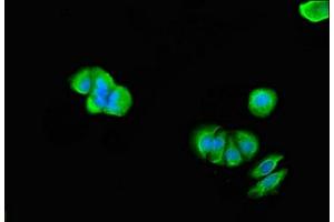 Immunofluorescent analysis of MCF-7 cells using ABIN7172041 at dilution of 1:100 and Alexa Fluor 488-congugated AffiniPure Goat Anti-Rabbit IgG(H+L) (TMX2 抗体  (AA 49-102))