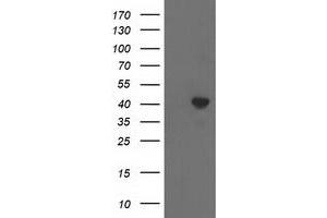 HEK293T cells were transfected with the pCMV6-ENTRY control (Left lane) or pCMV6-ENTRY ACAT2 (Right lane) cDNA for 48 hrs and lysed. (ACAT2 抗体)