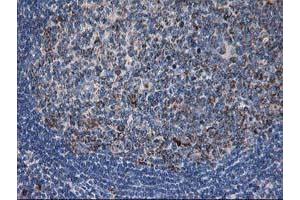 Image no. 1 for anti-Dihydrolipoamide Dehydrogenase (DLD) antibody (ABIN1497847) (DLD 抗体)