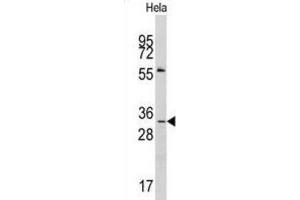 Western Blotting (WB) image for anti-Melanoma Antigen Family A, 1 (Directs Expression of Antigen MZ2-E) (MAGEA1) antibody (ABIN3002531) (MAGEA1 抗体)