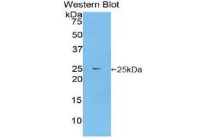 Western Blotting (WB) image for anti-Fibroblast Growth Factor Receptor Substrate 2 (FRS2) (AA 268-453) antibody (ABIN1858918) (FRS2 抗体  (AA 268-453))