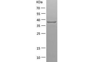 Western Blotting (WB) image for Coproporphyrinogen Oxidase (CPOX) (AA 111-454) protein (His tag) (ABIN7122483) (CPOX Protein (AA 111-454) (His tag))