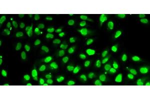 Immunofluorescence analysis of HeLa cells using PBEF / NAMPT Polyclonal Antibody (NAMPT 抗体)