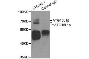 Western Blotting (WB) image for anti-ATG16 Autophagy Related 16-Like 1 (ATG16L1) antibody (ABIN1871137) (ATG16L1 抗体)