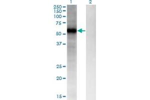Western Blot analysis of FZD4 expression in transfected 293T cell line by FZD4 monoclonal antibody (M02A), clone 3G7. (FZD4 抗体  (AA 107-206))