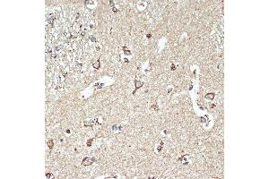 Immunohistochemistry of paraffin-embedded human brain using SR-B2/SR-B2/LIMPII Rabbit mAb (ABIN7270157) at dilution of 1:100 (40x lens). (SCARB2 抗体)
