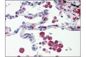 Immunohistochemistry (IHC) image for anti-Interferon Regulatory Factor 7 (IRF7) (AA 1-150), (N-Term) antibody (ABIN263914) (IRF7 抗体  (N-Term))
