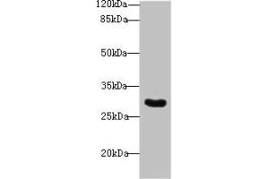 Western blot All lanes: Snrnp35 antibody at 12 μg/mL + Jurkat whole cell lysate Secondary Goat polyclonal to rabbit IgG at 1/10000 dilution Predicted band size: 29 kDa Observed band size: 29 kDa (SNRNP35 抗体  (AA 1-244))