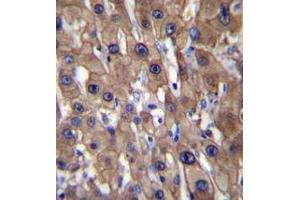 Immunohistochemistry analysis in formalin fixed and paraffin embedded human liver tissue reacted with MAT1A Antibody (N-term) followed which was peroxidase conjugated to the secondary antibody and  followed by DAB staining. (MAT1A 抗体  (N-Term))
