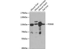 Western blot analysis of extracts of various cell lines, using PDE6B antibody (ABIN6132473, ABIN6145363, ABIN6145364 and ABIN6222688) at 1:1000 dilution. (PDE6B 抗体  (AA 1-190))